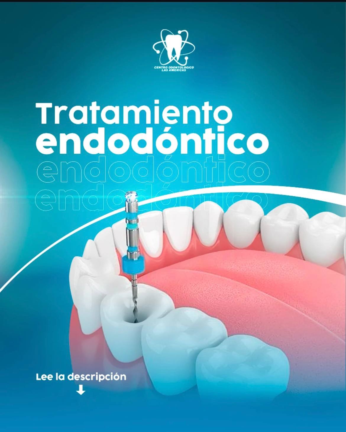 Endodoncia
